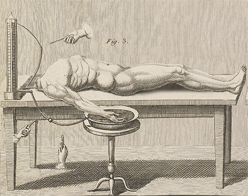 An illustration of a headless human torso moving a leg when electrical current is applied